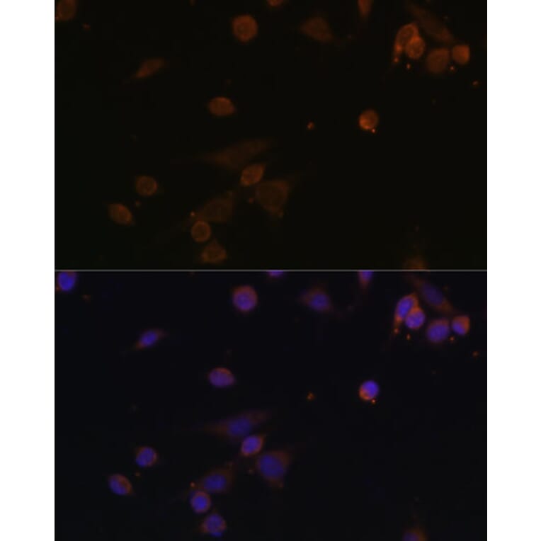 Immunofluorescence - Anti-NDUFA2 Antibody (A12213) - Antibodies.com