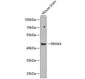 Western Blot - Anti-FBXW4 Antibody (A12214) - Antibodies.com