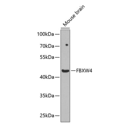 Western Blot - Anti-FBXW4 Antibody (A12214) - Antibodies.com