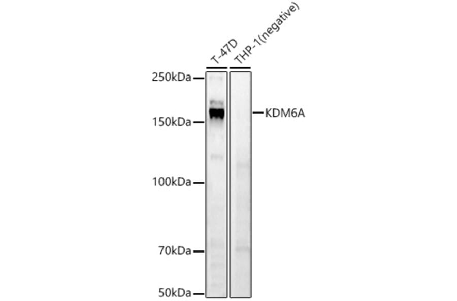Western Blot - Anti-KDM6A/UTX Antibody (A12215) - Antibodies.com