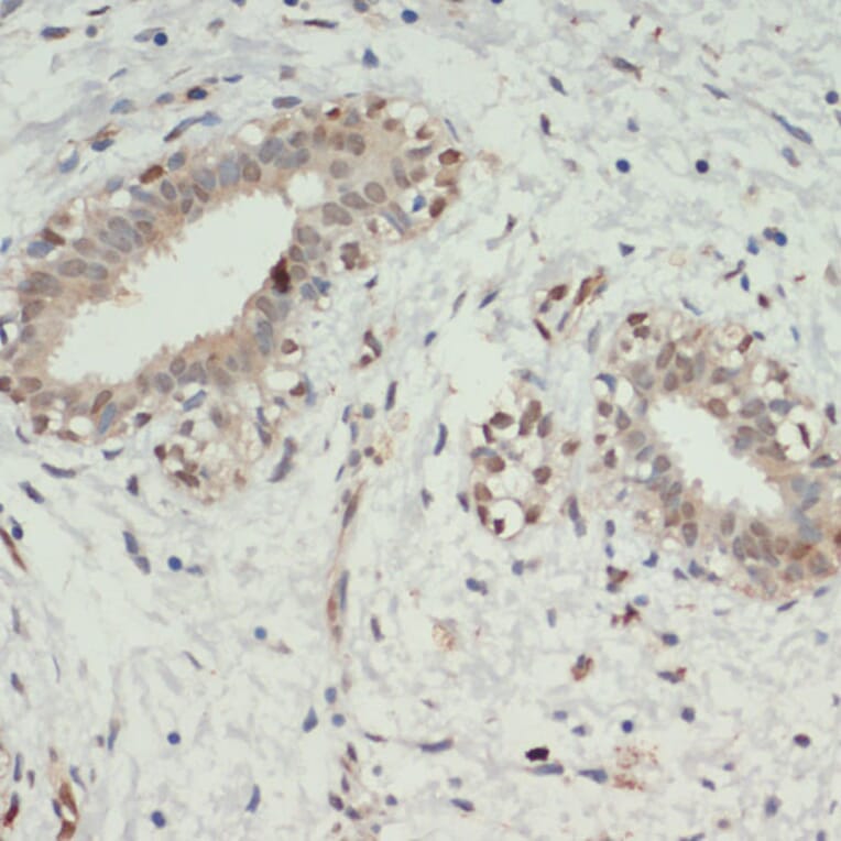 Immunohistochemistry - Anti-KDM6A/UTX Antibody (A12215) - Antibodies.com