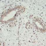 Immunohistochemistry - Anti-KDM6A/UTX Antibody (A12215) - Antibodies.com