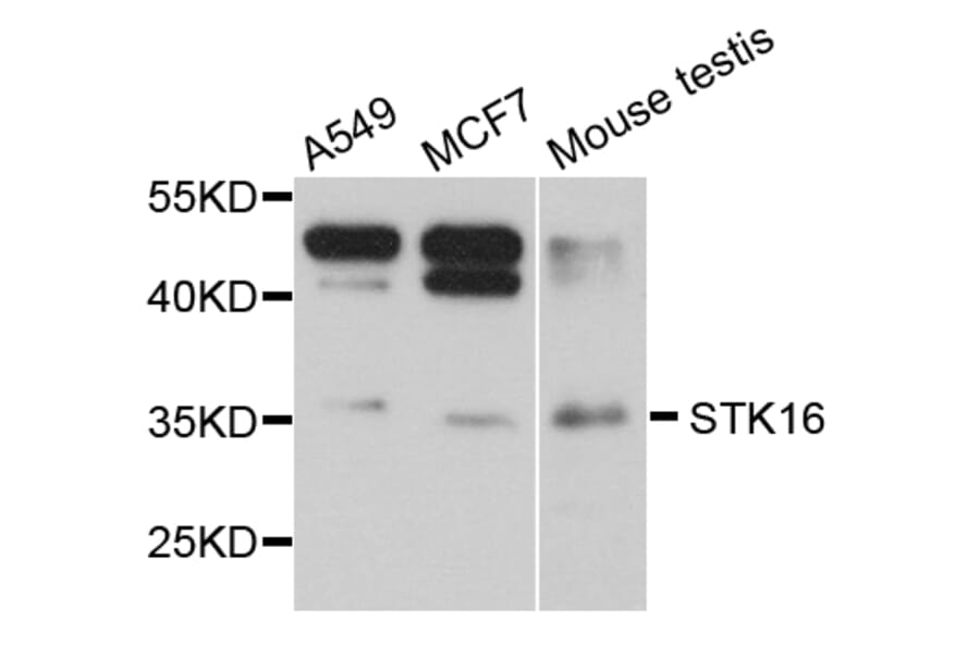 Western Blot - Anti-STK16 Antibody (A8166) - Antibodies.com