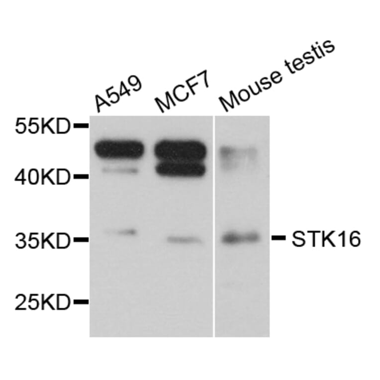 Western Blot - Anti-STK16 Antibody (A8166) - Antibodies.com