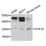 Western Blot - Anti-STK16 Antibody (A8166) - Antibodies.com