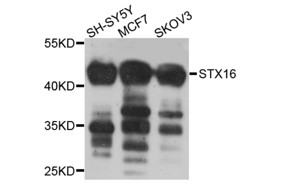 Western Blot - Anti-STX16 Antibody (A8168) - Antibodies.com