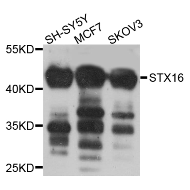 Western Blot - Anti-STX16 Antibody (A8168) - Antibodies.com