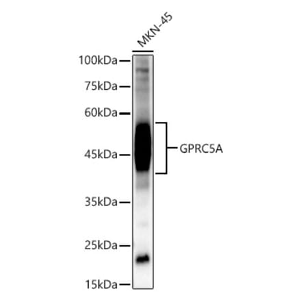 Western Blot - Anti-GPRC5A Antibody (A12218) - Antibodies.com