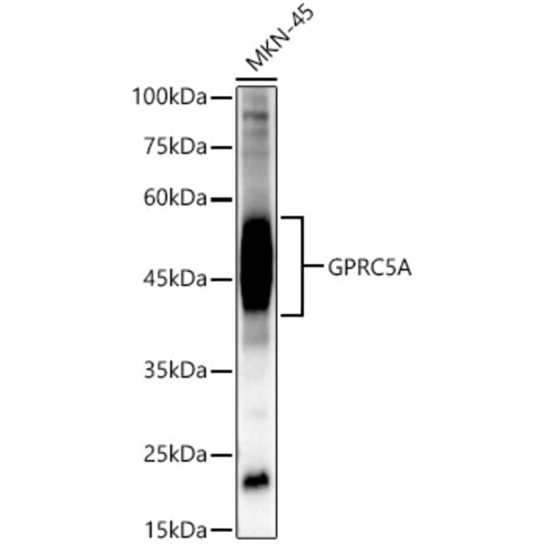 Western Blot - Anti-GPRC5A Antibody (A12218) - Antibodies.com