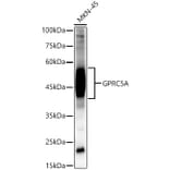 Western Blot - Anti-GPRC5A Antibody (A12218) - Antibodies.com