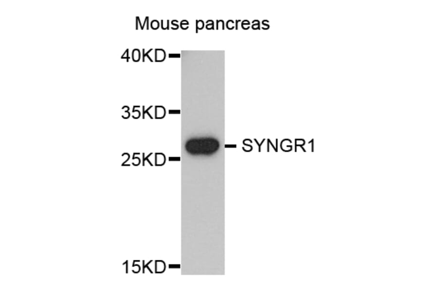 Western Blot - Anti-SYNGR1 Antibody (A8175) - Antibodies.com