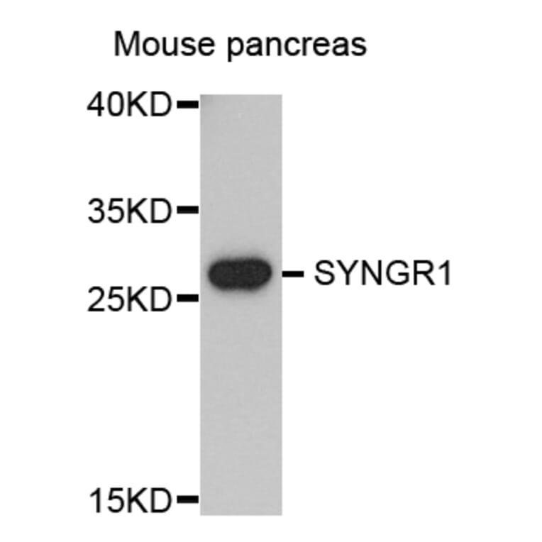 Western Blot - Anti-SYNGR1 Antibody (A8175) - Antibodies.com