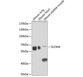 Western Blot - Anti-NHE-6 Antibody (A12221) - Antibodies.com