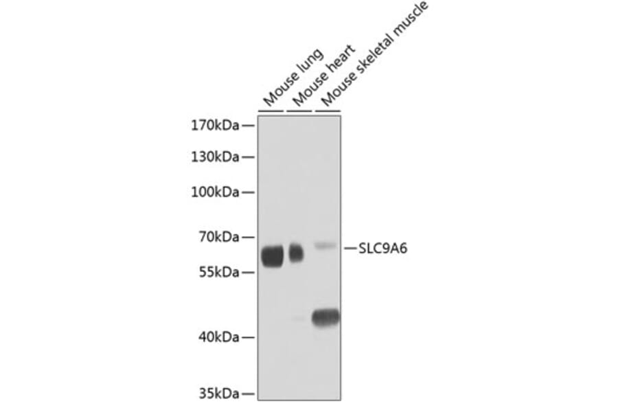 Western Blot - Anti-NHE-6 Antibody (A12221) - Antibodies.com