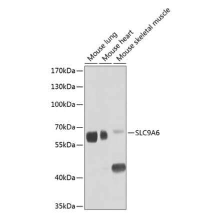 Western Blot - Anti-NHE-6 Antibody (A12221) - Antibodies.com