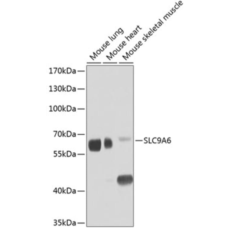 Western Blot - Anti-NHE-6 Antibody (A12221) - Antibodies.com