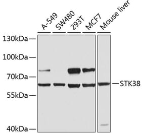 Western Blot - Anti-STK38 Antibody (A12222) - Antibodies.com