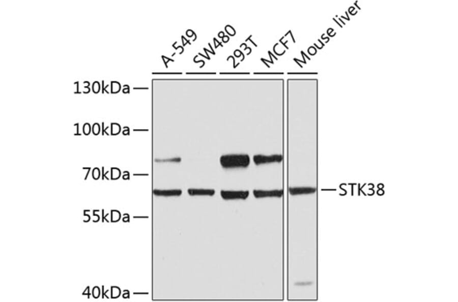 Western Blot - Anti-STK38 Antibody (A12222) - Antibodies.com