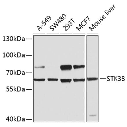 Western Blot - Anti-STK38 Antibody (A12222) - Antibodies.com