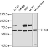 Western Blot - Anti-STK38 Antibody (A12222) - Antibodies.com