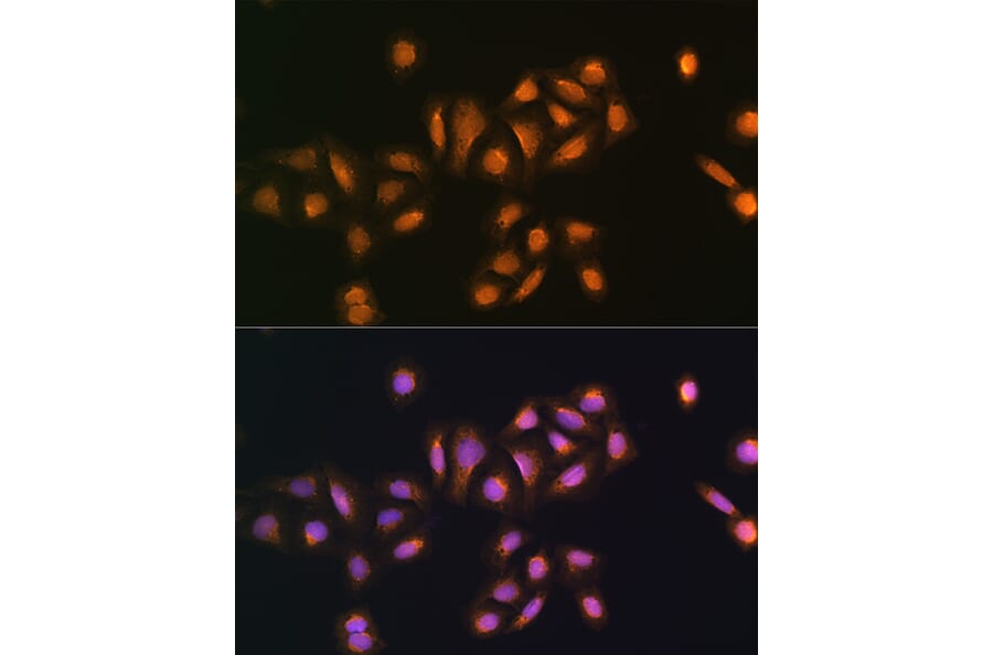Immunofluorescence - Anti-STK38 Antibody (A12222) - Antibodies.com