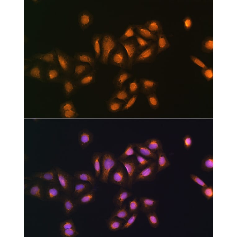 Immunofluorescence - Anti-STK38 Antibody (A12222) - Antibodies.com