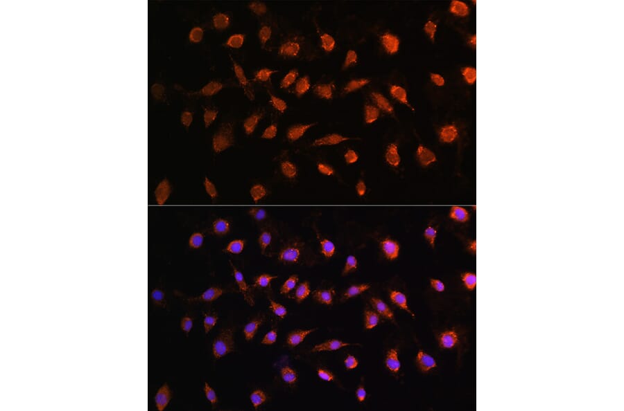 Immunofluorescence - Anti-STK38 Antibody (A12222) - Antibodies.com