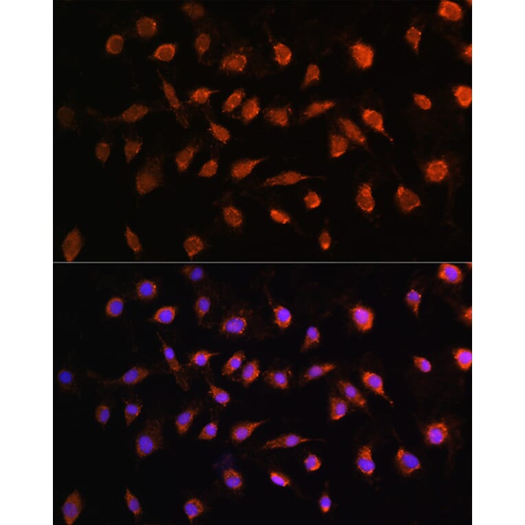 Immunofluorescence - Anti-STK38 Antibody (A12222) - Antibodies.com