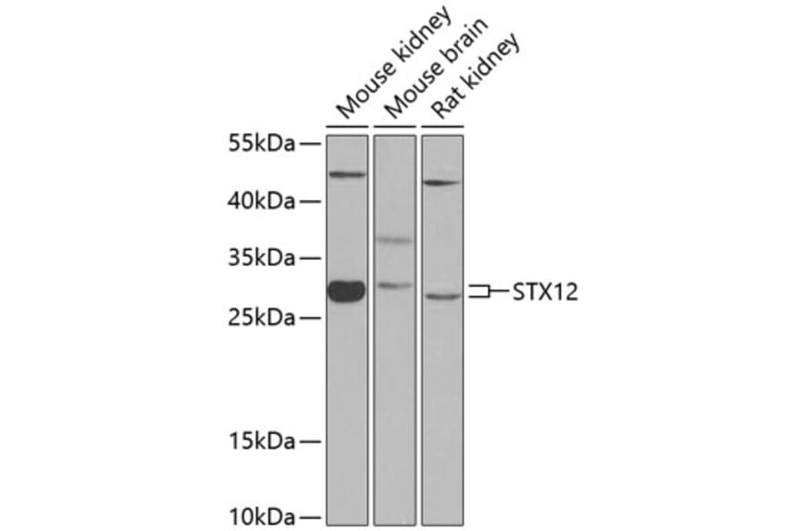 Western Blot - Anti-Syntaxin 12/Syntaxin-13 Antibody (A12223) - Antibodies.com