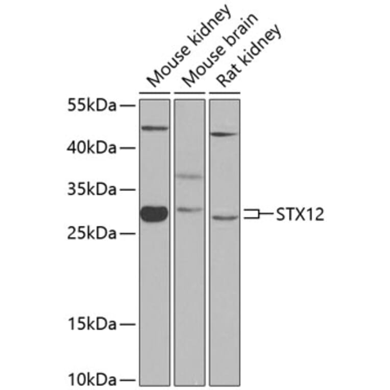 Western Blot - Anti-Syntaxin 12/Syntaxin-13 Antibody (A12223) - Antibodies.com