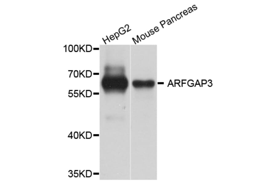 Western Blot - Anti-ARFGAP3 Antibody (A8204) - Antibodies.com