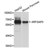 Western Blot - Anti-ARFGAP3 Antibody (A8204) - Antibodies.com