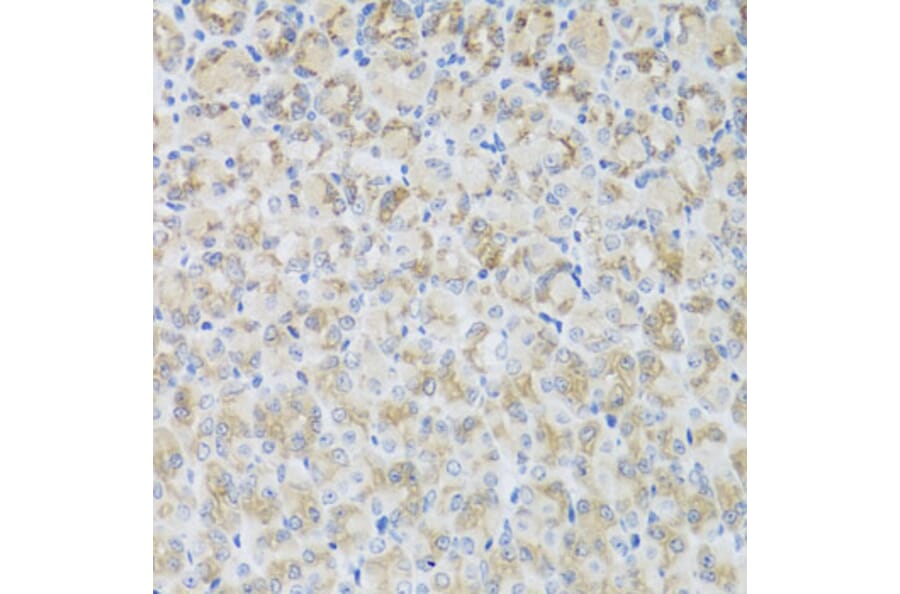 Immunohistochemistry - Anti-ARFGAP3 Antibody (A8204) - Antibodies.com