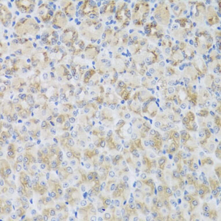 Immunohistochemistry - Anti-ARFGAP3 Antibody (A8204) - Antibodies.com
