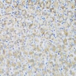 Immunohistochemistry - Anti-ARFGAP3 Antibody (A8204) - Antibodies.com