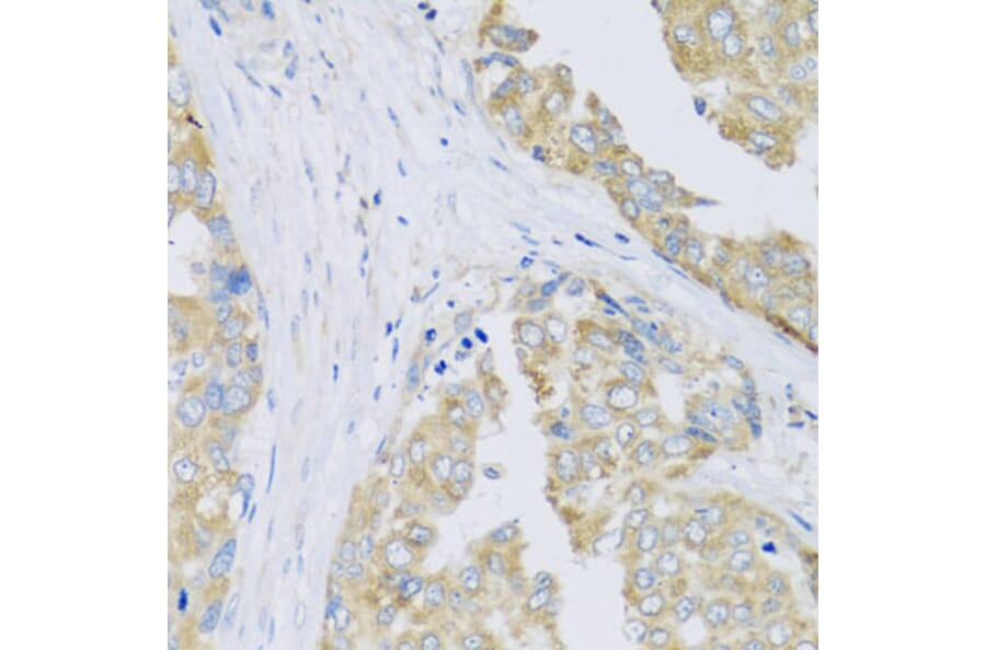 Immunohistochemistry - Anti-ARFGAP3 Antibody (A8204) - Antibodies.com