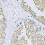 Immunohistochemistry - Anti-ARFGAP3 Antibody (A8204) - Antibodies.com