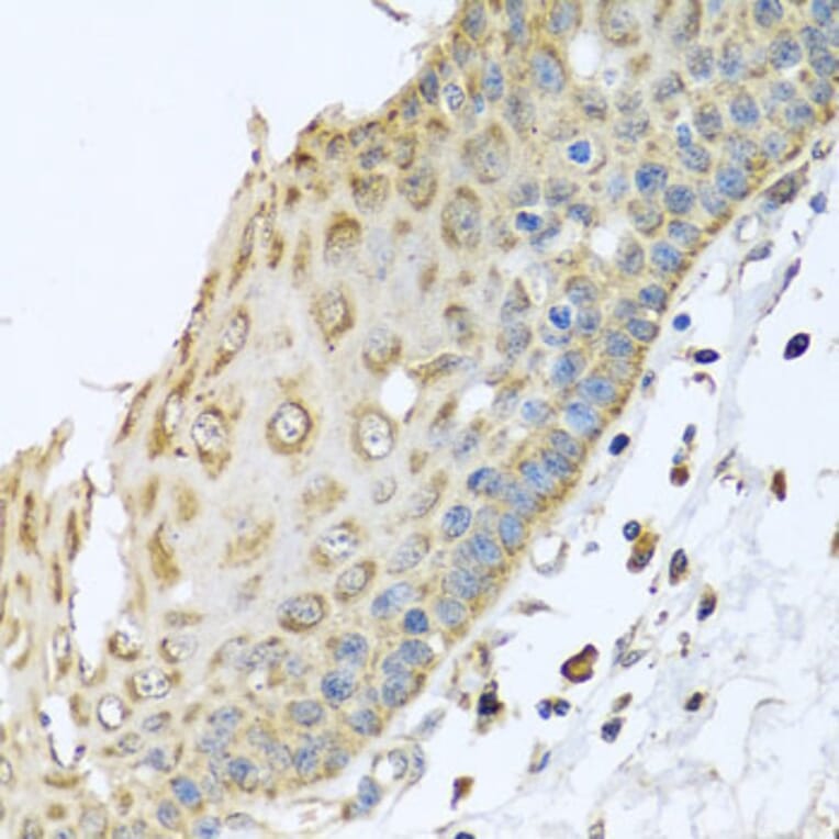 Immunohistochemistry - Anti-ARFGAP3 Antibody (A8204) - Antibodies.com