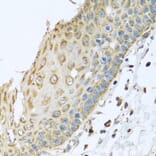Immunohistochemistry - Anti-ARFGAP3 Antibody (A8204) - Antibodies.com