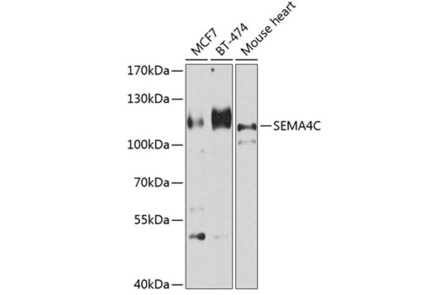 Western Blot - Anti-SEMA4C/SEMAI Antibody (A12225) - Antibodies.com