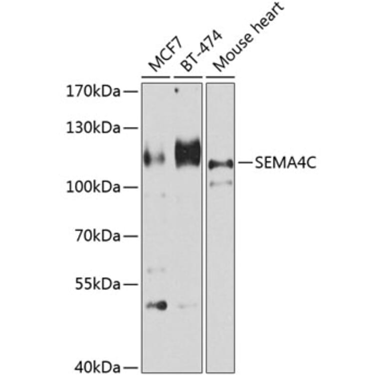 Western Blot - Anti-SEMA4C/SEMAI Antibody (A12225) - Antibodies.com