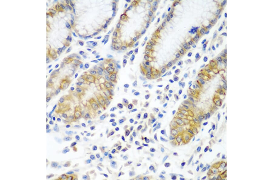Immunohistochemistry - Anti-ATAD3A Antibody (A12226) - Antibodies.com