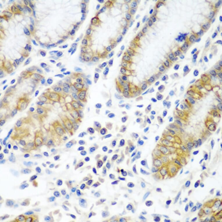 Immunohistochemistry - Anti-ATAD3A Antibody (A12226) - Antibodies.com