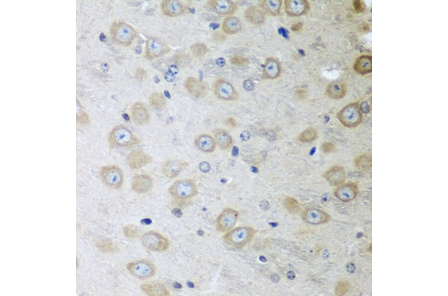 Immunohistochemistry - Anti-ATAD3A Antibody (A12226) - Antibodies.com