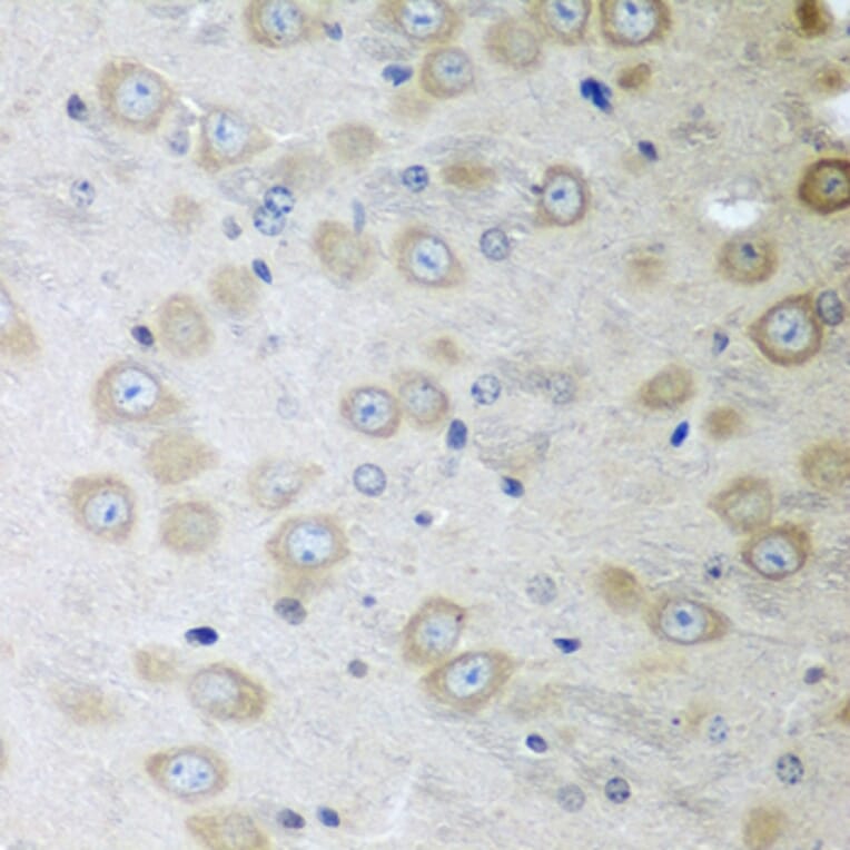 Immunohistochemistry - Anti-ATAD3A Antibody (A12226) - Antibodies.com