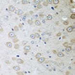 Immunohistochemistry - Anti-ATAD3A Antibody (A12226) - Antibodies.com