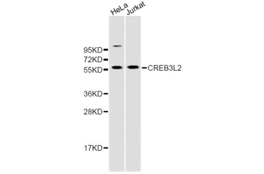 Western Blot - Anti-CREB3L2 Antibody (A8251) - Antibodies.com