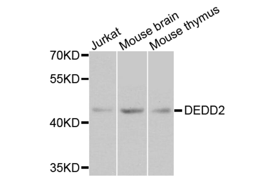 Western Blot - Anti-DEDD2 Antibody (A8281) - Antibodies.com