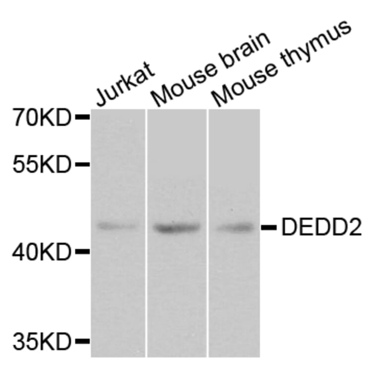 Western Blot - Anti-DEDD2 Antibody (A8281) - Antibodies.com