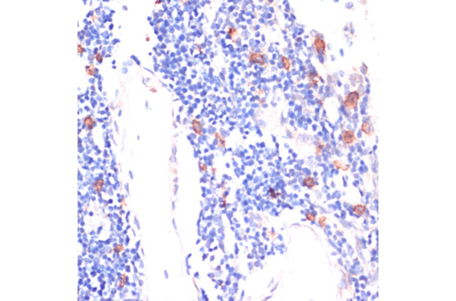 Immunohistochemistry - Anti-Wnt5b Antibody (A12230) - Antibodies.com